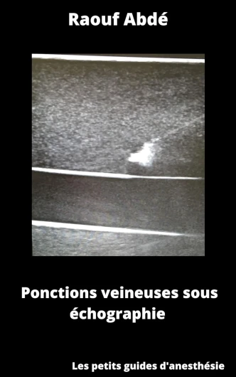 Ponctions veineuses sous échographie (petit guide pour l'anesthésie)