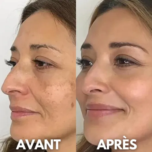 61f-NZ-FoFL._AC_SL1080_