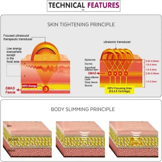 Appareil de Raffermissement Cutané 3D Hifu,pour Raffermir Les Rides et Le Front,Lifting du Visage pour Un Usage en Salon et à Domicile,5Heads