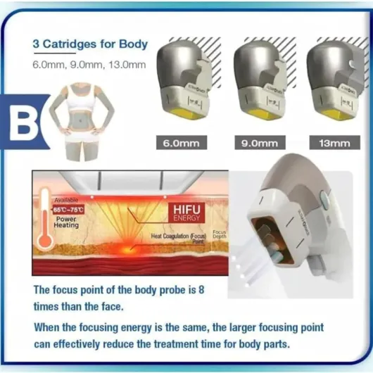 71ymhI2c91L._AC_SL1500_