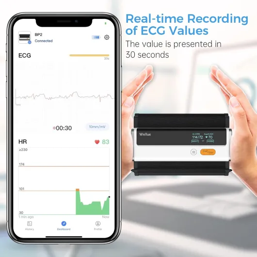 71gyAtMOqmL._SL1500_