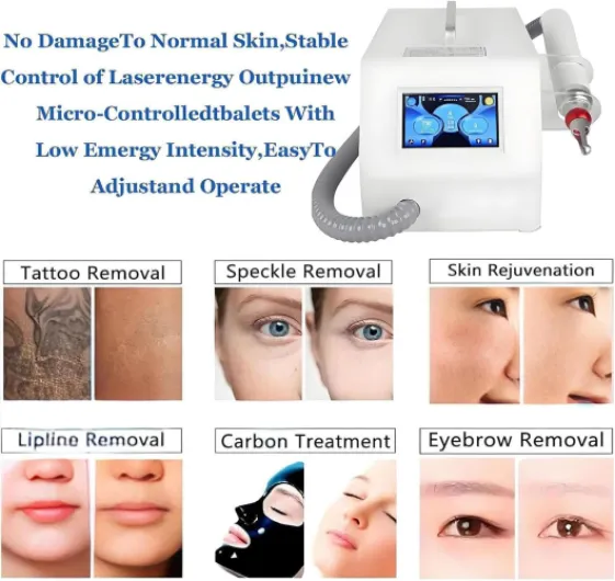 71jXQPgaBHL._AC_SL1500_