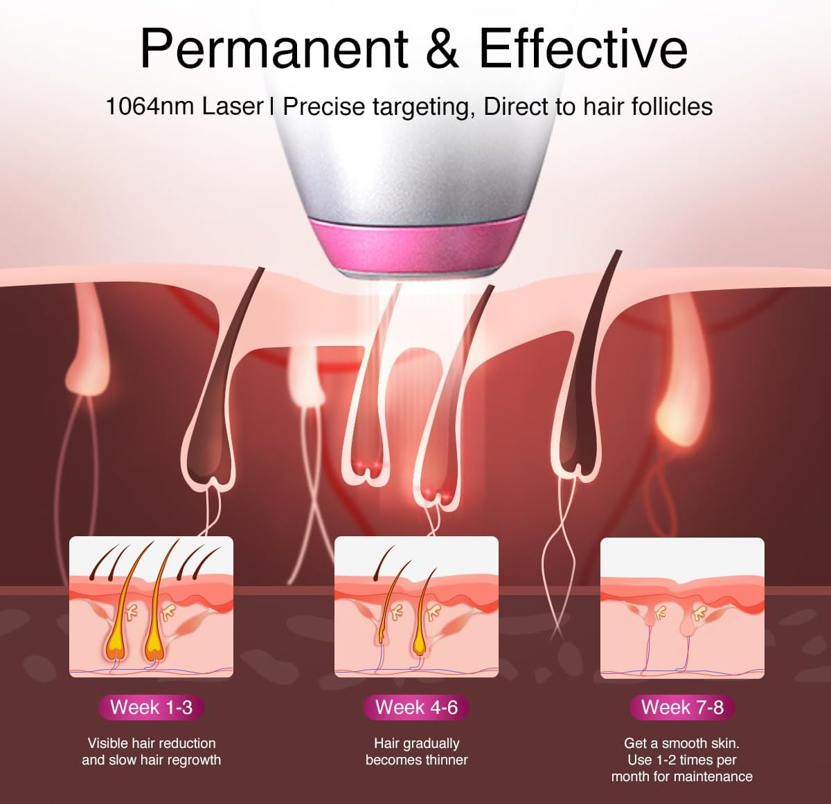 Épilation laser à diode 1064 nm pour femmes et hommes, pour tons de peau 1-6, refroidissement par glace, épilation grand angle pour le visage, le corps, pour les peaux profondes