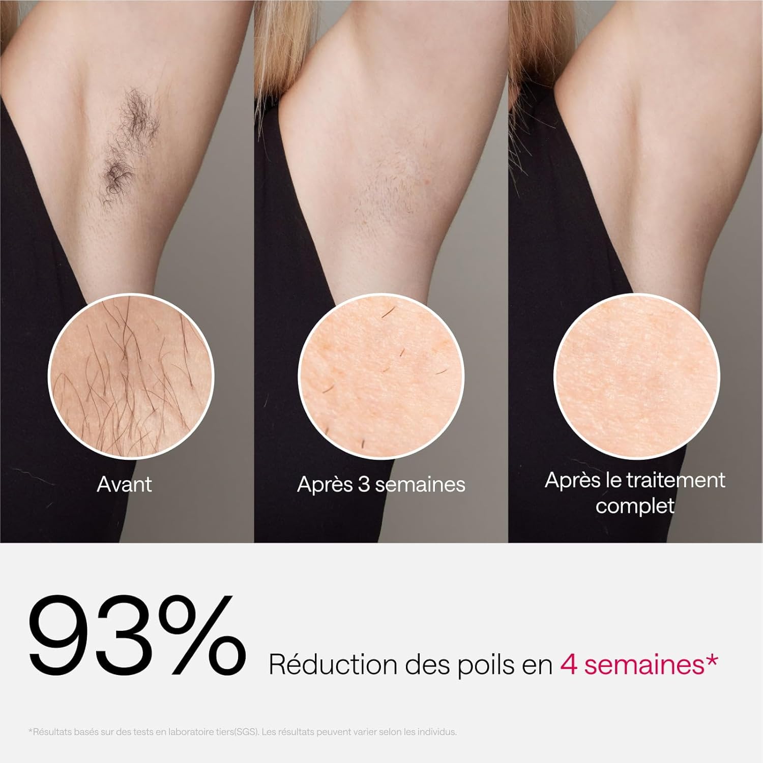 Air 3 Épilateur IPL pour les Femmes & Hommes – Épilation Laser avec Sapphire Ice Cooling, Résultats Durables et Presque Indolores, Tête Plate pour Corps et Visage, Violet