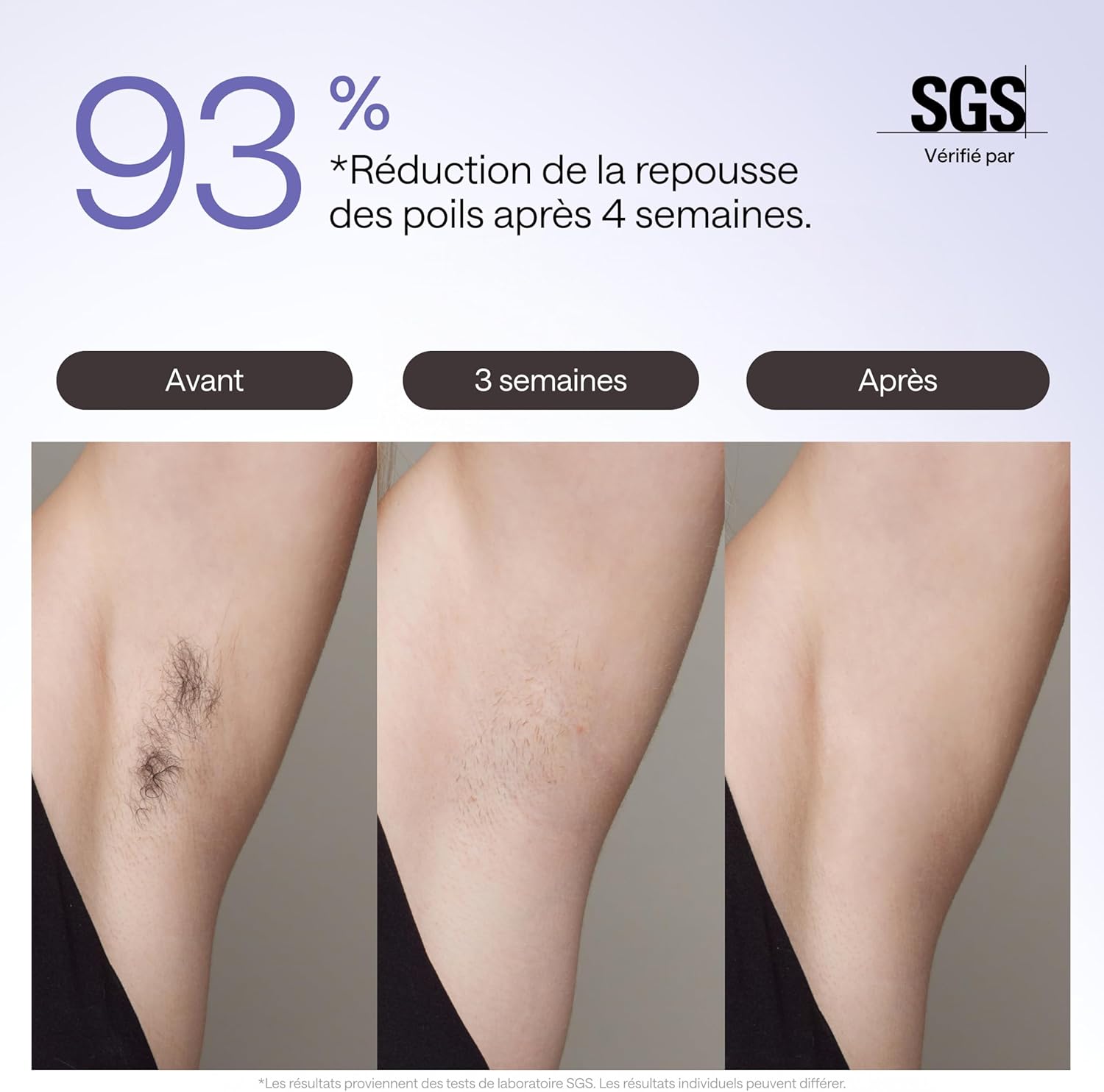 Épilateur à Lumière Pulsée Ulike Air 3 Deluxe, Sans Douleur Alternative au Laser, Convient aux Peaux Sensibles, 4 accessoires pour le corps, le visage, le maillot et les aisselles