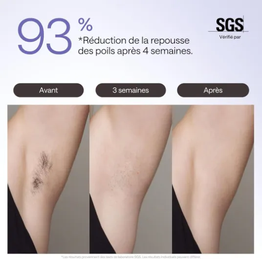 Épilateur à Lumière Pulsée Ulike Air 3 Deluxe, Sans Douleur Alternative au Laser, Convient aux Peaux Sensibles, 4 accessoires pour le corps, le visage, le maillot et les aisselles