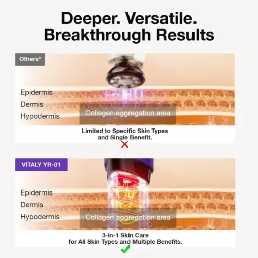 Test VITALY Glow-Pro HBR2-1 : l’appareil anti-âge maison qui fait (un peu) le job si on est patient