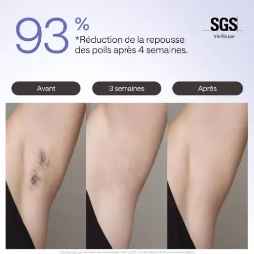 Test Ulike Air 3 Deluxe : l’IPL qui fait (presque) oublier l’esthéticienne