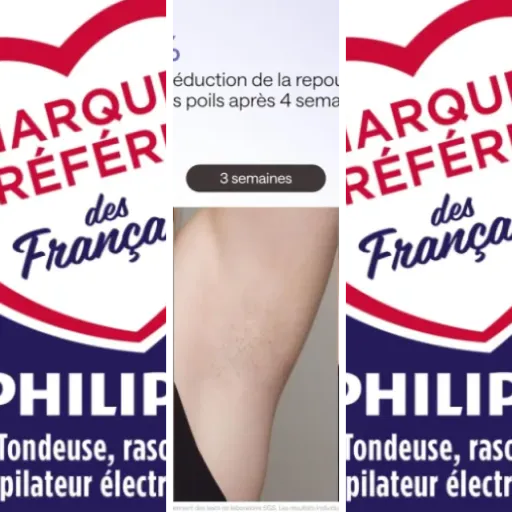 Top 6 : meilleurs appareils IPL professionnels pour le corps (avril 2026)