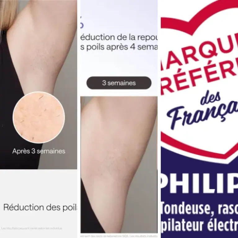 Les meilleurs appareils laser pour épilation des zones sensibles : notre top 5 (2026)