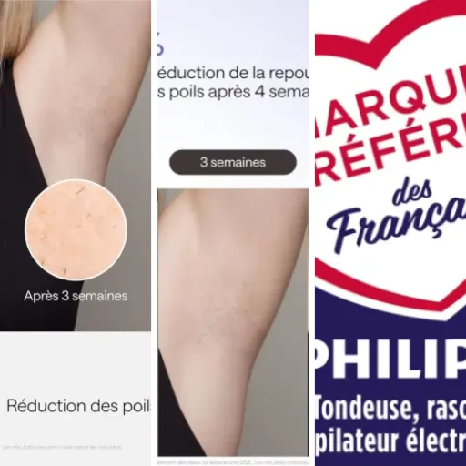 Les meilleurs appareils laser pour épilation des zones sensibles : notre top 5 (avril 2026)