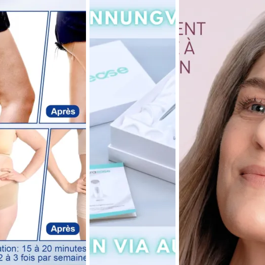 Les meilleurs appareils combinés radiofréquence et ultrasons : notre top 5 (2026)
