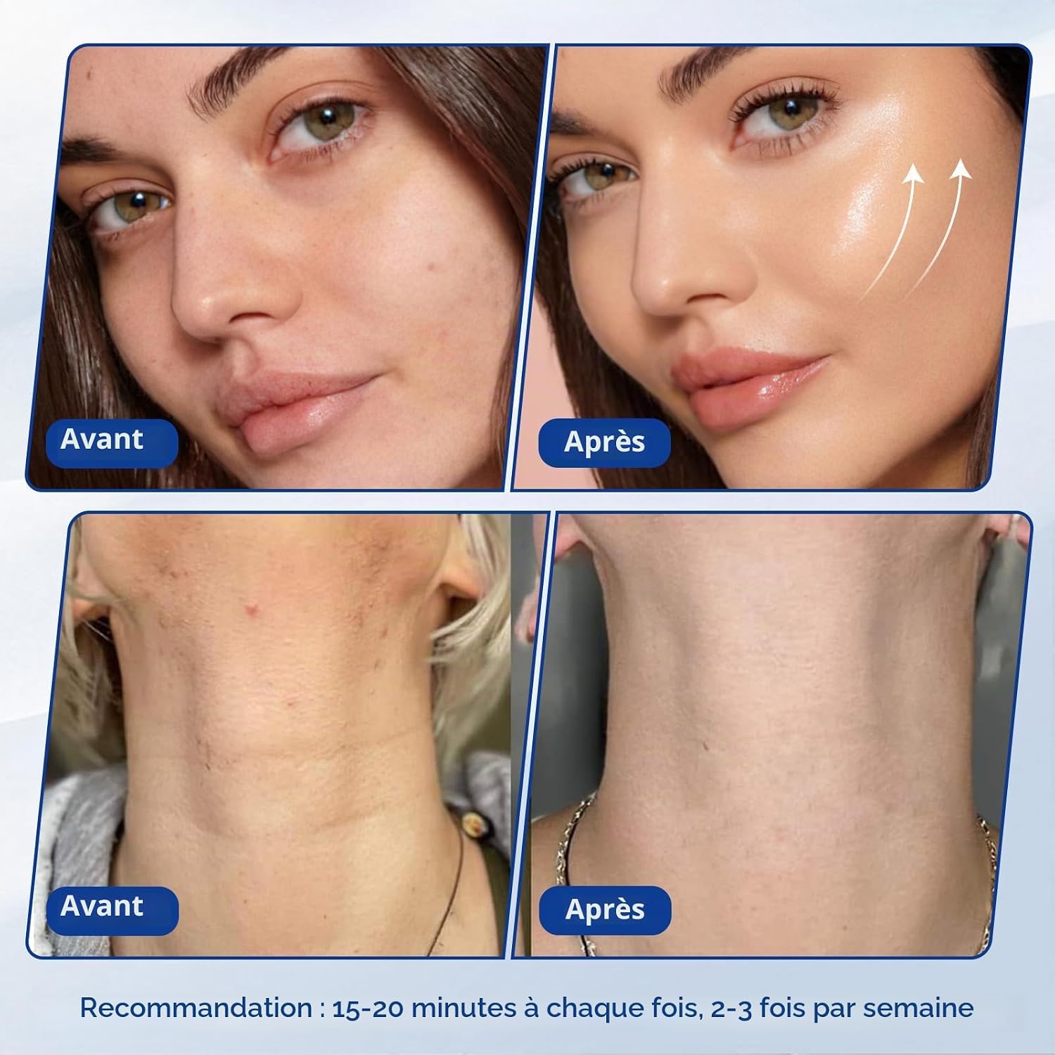 Cellulite 3-en-1 40K Cavitation et radiofréquence - RF 9 niveaux, ventouses visage et corps, facile et confortable à la maison Blanc