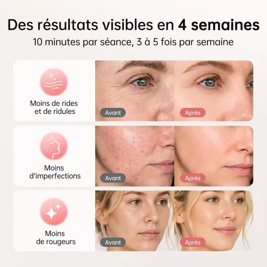 Masque LED Visage Sans Fil, 4 Modes Masque Luminothérapie Lumière Rouge & Infrarouge 850 nm, LED Mask, Télécommande, Autonomie 60 min, Réglable, avec Couvre-yeux, NVV04 Noir