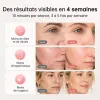 Test XSSNVV NVV04 : un masque LED sans fil correct, mais avec un vrai souci côté yeux